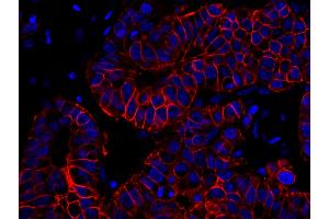 Immunofluorescence (IF) image for anti-Receptor tyrosine-protein kinase erbB-2 (ErbB2/Her2) (C-Term) antibody (ABIN7448962) (ErbB2/Her2 antibody  (C-Term))