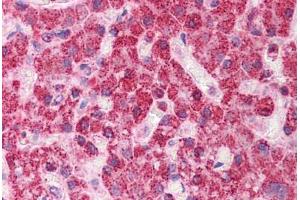 Human Liver: Formalin-Fixed, Paraffin-Embedded (FFPE) (TST antibody  (AA 101-150))