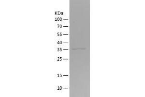 GLUT1 Protein (AA 210-280) (His-IF2DI Tag)