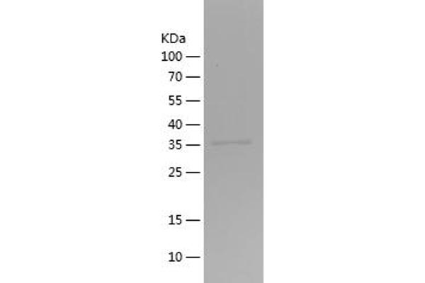 GLUT1 Protein (AA 210-280) (His-IF2DI Tag)