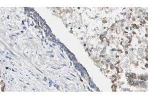 ABIN6268658 at 1/100 staining Human prostate tissue by IHC-P. (PIK3CA antibody  (Internal Region))