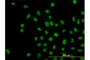 Immunofluorescence of monoclonal antibody to ARID1B on HeLa cell. (ARID1B antibody  (AA 1364-1460))
