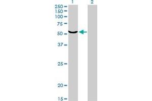 Western Blot analysis of TOE1 expression in transfected 293T cell line by TOE1 monoclonal antibody (M01), clone 1D8.