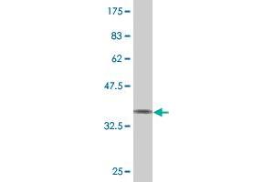 Western Blot detection against Immunogen (37. (Spastin antibody  (AA 200-304))