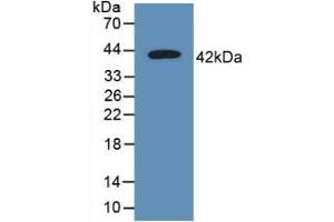 Detection of Recombinant CD63, Human using Polyclonal Antibody to Tetraspanin 30Cluster of Differentiation 63 (CD63) (CD63 antibody  (AA 103-203))