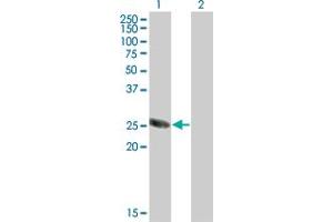 Western Blot analysis of TSSK3 expression in transfected 293T cell line by TSSK3 monoclonal antibody (M07), clone 6B2. (TSSK3 antibody  (AA 1-268))