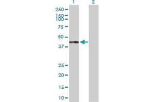 Western Blot analysis of TRAF1 expression in transfected 293T cell line by TRAF1 MaxPab polyclonal antibody. (TRAF1 antibody  (AA 1-416))