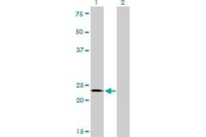 SALL2 antibody  (AA 1-198)