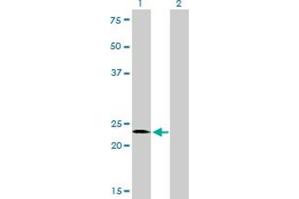 SALL2 antibody  (AA 1-198)