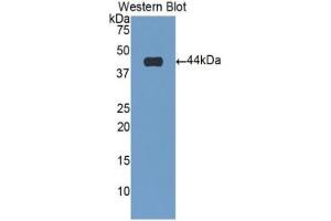 Western blot analysis of the recombinant protein. (Cardiac Troponin T2 antibody  (AA 2-100))