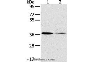 Western blot analysis of 293T and Raji cell, using SMN1 Polyclonal Antibody at dilution of 1:200 (SMN1 antibody)