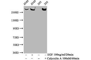Western Blot Positive WB detected in A549 whole cell lysate,293 whole cell lysate(treated with Calyculin A or EGF) All lanes Phospho-MTOR antibody at 1. (Recombinant MTOR antibody  (pSer2481))