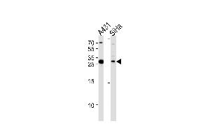 HSD17B12 Antibody (Center) (ABIN653300 and ABIN2842802) western blot analysis in A431,SiHa cell line lysates (35 μg/lane). (HSD17B12 antibody  (AA 126-155))