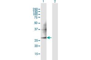 Western Blot analysis of PMM2 expression in transfected 293T cell line ( H00005373-T01 ) by PMM2 MaxPab polyclonal antibody. (PMM2 antibody  (AA 1-246))