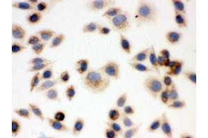 ICC testing of FFPE human SMMC-7721 cells with BAK antibody. (BAK1 antibody  (AA 22-211))