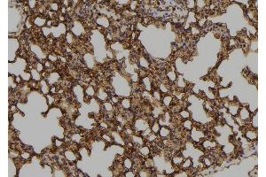ABIN6273575 at 1/100 staining Mouse lung tissue by IHC-P. (ZNF768 antibody  (Internal Region))