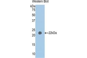 Detection of Recombinant PAPPA2, Human using Polyclonal Antibody to Pappalysin 2 (PAPPA2) (PAPPA2 antibody  (AA 1309-1492))