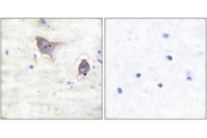 Immunohistochemistry analysis of paraffin-embedded human brain tissue, using Synuclein beta Antibody. (beta Synuclein antibody  (AA 85-134))