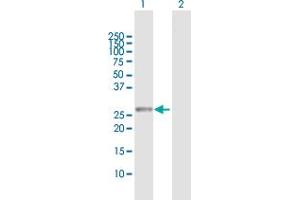 RAB23 antibody  (AA 1-237)