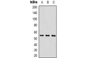 Western blot analysis of MICU1 expression in MCF7 (A), mouse brain (B), rat brain (C) whole cell lysates. (MICU1 antibody)