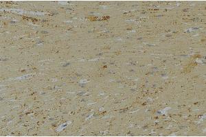 Immunohistochemistry (IHC) image for anti-Caldesmon 1 (CALD1) (C-Term) antibody (ABIN6260411)