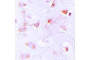 Immunohistochemical analysis of ACC alpha (pS80) staining in human brain formalin fixed paraffin embedded tissue section. (Acetyl-CoA Carboxylase alpha antibody  (N-Term, pSer80))