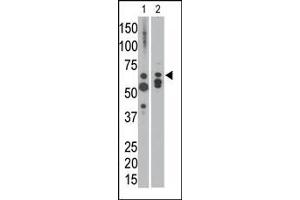 The anti-MTM1 C-term Pab is used in Western blot to detect MTM1 in NCI-H460 cell lysate (lane 1) and in mouse heart tissue lysate (lane 2).
