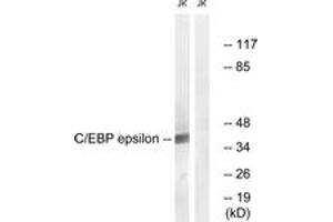 Western blot analysis of extracts from JurKat cells, treated with Insulin 0. (CEBPE antibody  (AA 40-89))