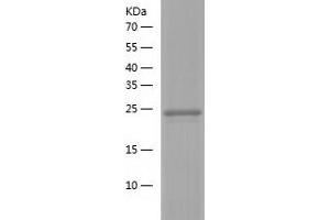 Western Blotting (WB) image for RAB24, Member RAS Oncogene Family (RAB24) (AA 1-227) protein (His tag) (ABIN7124743) (RAB24 Protein (AA 1-227) (His tag))
