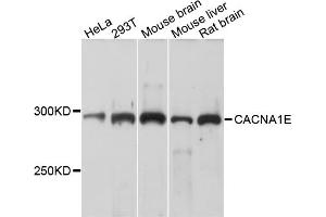 Western blot analysis of extracts of various cell lines, using CACNA1E antibody. (CACNA1E antibody)