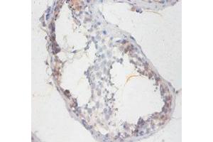 Immunohistochemistry of paraffin-embedded human testis tissue using ABIN7170460 at dilution of 1:100 (SMCP antibody  (AA 1-116))