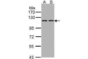 WB Image Sample(30 ug whole cell lysate) A:Hep G2 , B:HeLa S3, 7. (ENPEP antibody  (C-Term))