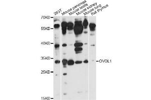 Western blot analysis of extracts of various cell lines, using OVOL1 antibody (ABIN6293430) at 1:1000 dilution.
