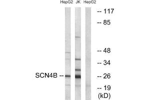 Western Blotting (WB) image for anti-Sodium Channel, Voltage-Gated, Type IV, beta Subunit (SCN4B) (Internal Region) antibody (ABIN1852172) (SCN4B antibody  (Internal Region))