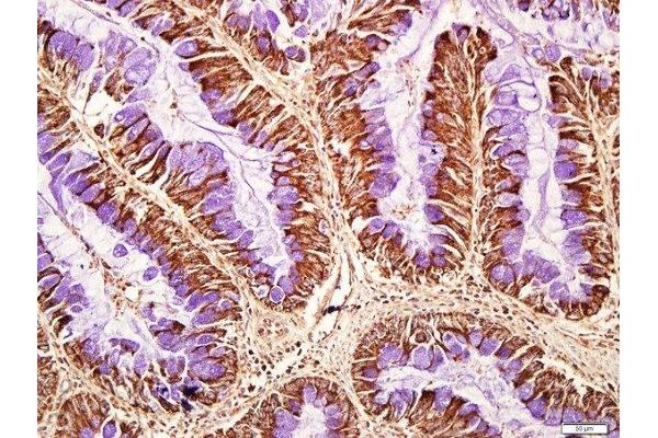 CD8B antibody  (AA 51-150)
