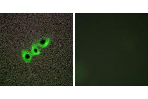 Peptide - +Immunohistochemistry analysis of paraffin-embedded human prostate carcinoma tissue, using RHG07 antibody. (DLC1 antibody)