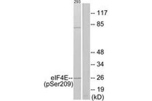 Western blot analysis of extracts from 293 cells treated with Anisomycin 25ug/ml 30', using eIF4E (Phospho-Ser209) Antibody. (EIF4E antibody  (pSer209))