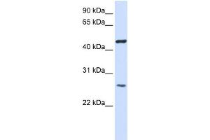 WB Suggested Anti-TMEM127 Antibody Titration:  0. (TMEM127 antibody  (Middle Region))