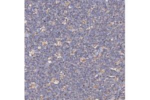 IHC analysis of CD74 using anti-CD74 antibody (ABIN7602385).