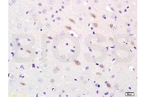 Formalin-fixed and paraffin-embedded : rat brain labeled with Rabbit Anti-NOS-2/iNOS Polyclonal Antibody, Unconjugated (ABIN677228) 1:200 followed by conjugation to the secondary antibody and DAB staining (NOS2 antibody  (AA 14-100))