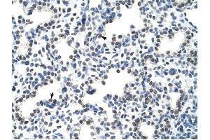 HNRPLL antibody was used for immunohistochemistry at a concentration of 4-8 ug/ml to stain Alveolar cells (arrows) in Human Lung. (HNRPLL antibody  (N-Term))
