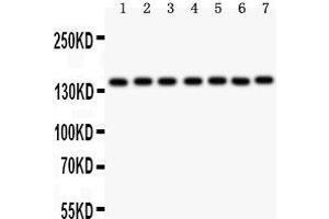 Western Blotting (WB) image for anti-Poly (ADP-Ribose) Polymerase 1 (PARP1) (AA 670-858) antibody (ABIN3043378) (PARP1 antibody  (AA 670-858))