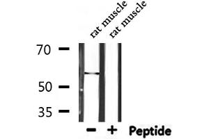 Western blot analysis of extracts from rat muscle, using TPH1  Antibody. (Tryptophan Hydroxylase 1 antibody  (Internal Region))