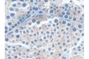 IHC-P analysis of Mouse Testis Tissue, with DAB staining. (MAP4 antibody  (AA 882-1062))