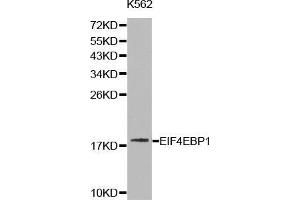 Western blot analysis of K562 cell lysate using EIF4EBP1 antibody. (eIF4EBP1 antibody  (C-Term))