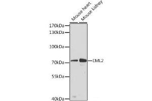 Western blot analysis of extracts of various cell lines using EML2 Polyclonal Antibody at dilution of 1:3000. (EML2 antibody)