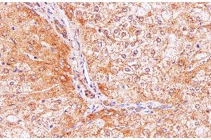 Immunohistochemistry of paraffin-embedded Human liver using IL2 Polyclonal Antibody at dilution of 1:100 (IL-2 antibody)