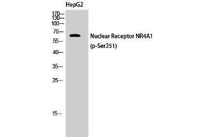 Western Blotting (WB) image for anti-Nuclear Receptor Subfamily 4, Group A, Member 1 (NR4A1) (pSer351) antibody (ABIN3173442) (NR4A1 antibody  (pSer351))