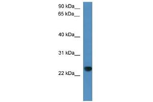 WB Suggested Anti-Capsl Antibody Titration: 0. (CAPSL antibody  (C-Term))