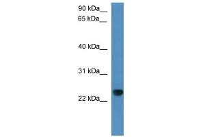 WB Suggested Anti-Capsl Antibody Titration: 0.